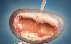 鄭大一附院試管嬰兒費(fèi)用大約多少