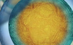 南京中大醫(yī)院試管嬰兒的費(fèi)用貴嗎