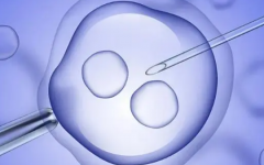 去泰國(guó)做試管好評(píng)