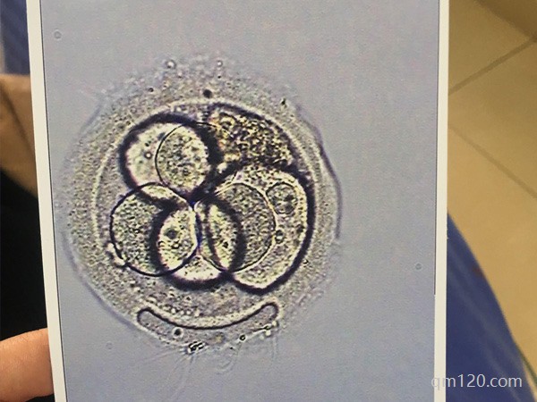 三代試管容易出現(xiàn)嵌合體