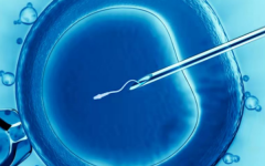 三代試管在哪里做比較好