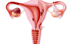 輸卵管堵塞做試管能成功嗎