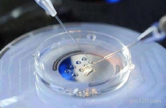 無(wú)痛促排卵多少錢一次