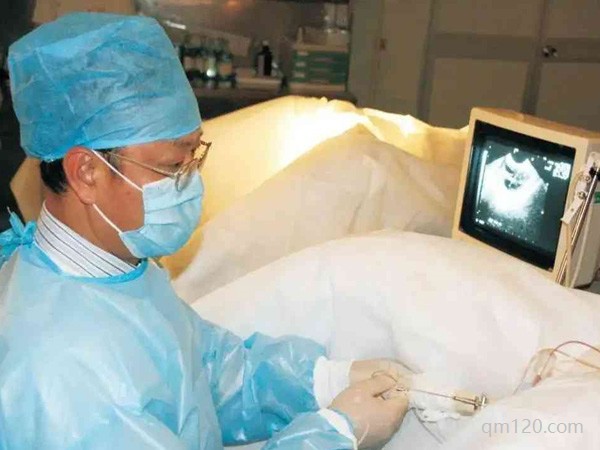 試管超長方案和長方案的區(qū)別