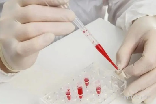 試管嬰兒建檔需要什么材料