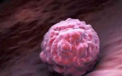 尿酸高可以做試管嗎