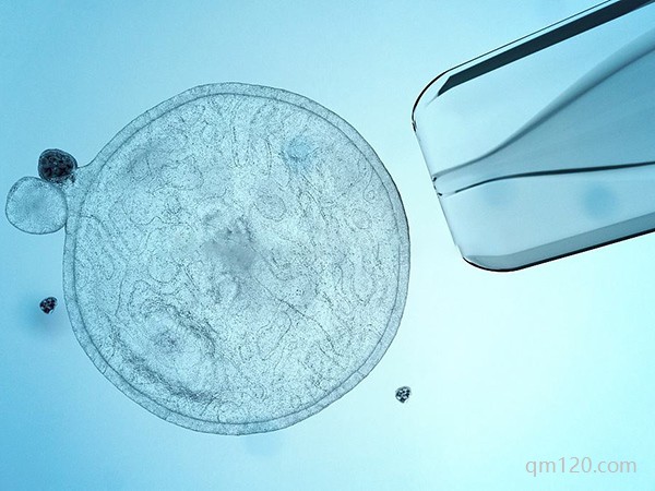 試管嬰兒做一個(gè)孩子行嗎