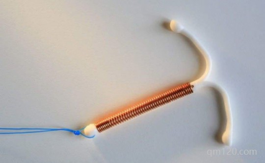 節(jié)育環(huán)