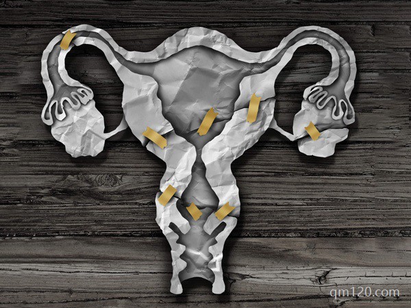 三種女人不能做試管