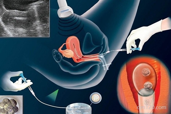 b超下移植和盲移的區(qū)別