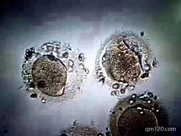 第三代試管為什么只能移植一個(gè)