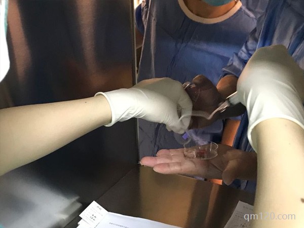 試管嬰兒促排卵手術(shù)全過程