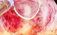 滄州市試管助孕中心試管嬰兒費(fèi)用