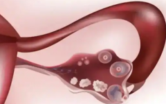 女性不能生育能做試管嗎