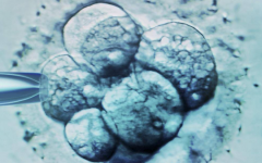 宜賓市第二試管助孕中心試管嬰兒費用