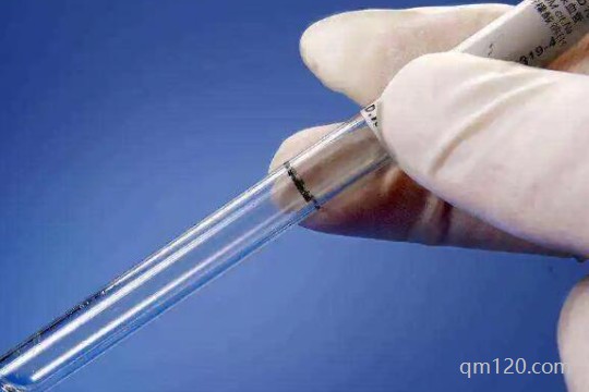 試管建檔前要做哪些檢查