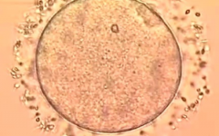 杭州市婦產(chǎn)科醫(yī)院做試管嬰兒大約多少錢