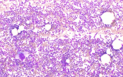 CD38陽性可以做試管嗎