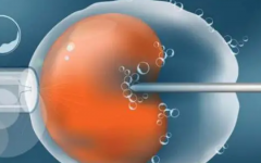 泰國(guó)試管嬰兒常見(jiàn)套路