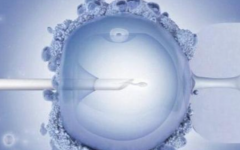 南寧助孕生孩子費用