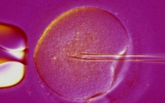 河北醫(yī)科大學(xué)第二醫(yī)院試管嬰兒多少錢