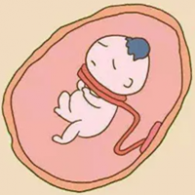 臍帶繞頸