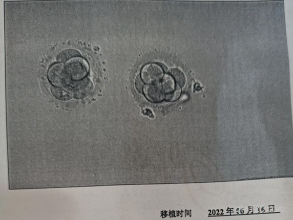 囊胚4aa移植成功的幾率多高