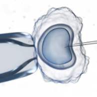 第一代試管嬰兒