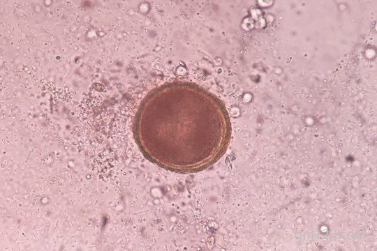 胚胎6aa好還是5aa好