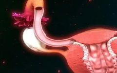 有卵巢無子宮可以促排卵做試管嗎