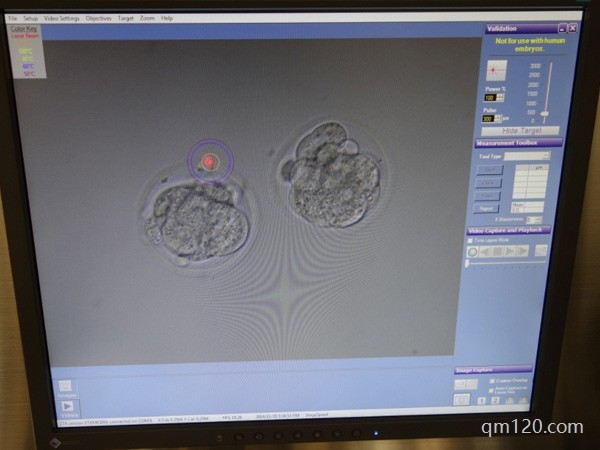 三代試管養(yǎng)囊后送檢要多久