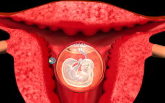 子宮內(nèi)膜薄能不能做試管嬰兒