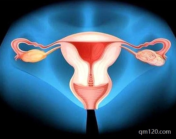 腺肌癥最怕三種運動