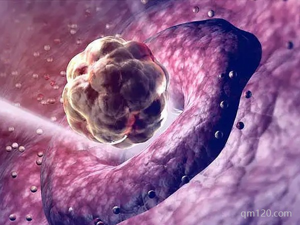 試管不著床與生化哪個更可怕