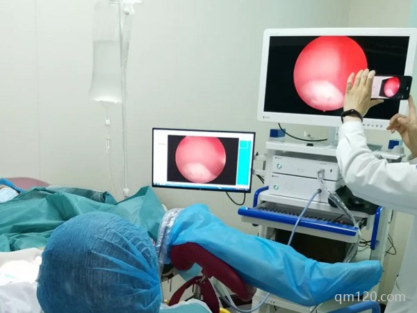 試管種植窗有沒有必要做