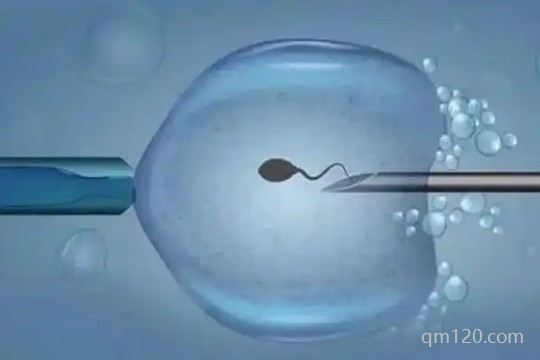 試管嬰兒短方案的流程