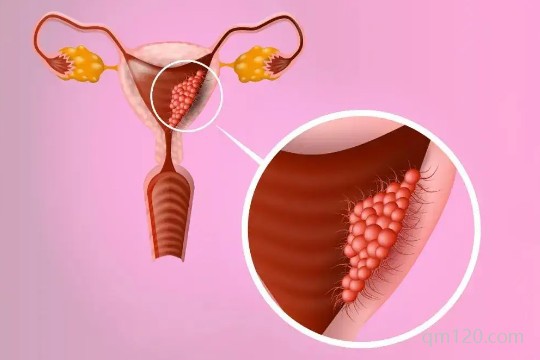 卵泡左邊4個右邊5個正常嗎
