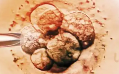 新疆婦幼保健院試管多少錢