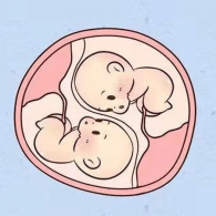 多胎妊娠