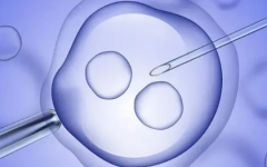 如何聯(lián)系去泰國做試管