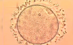 三明第三醫(yī)院做試管花費(fèi)高不高