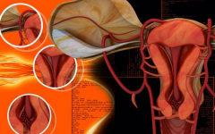 輸卵管有積水能做試管嗎
