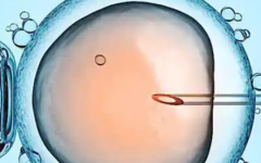 廈門大學附屬中山醫(yī)院做試管嬰兒成功率大嗎