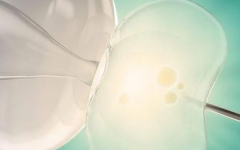 哪里做試管便宜成功率又高