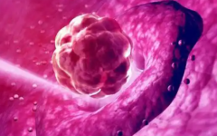 54歲以上適合做幾代試管嬰兒