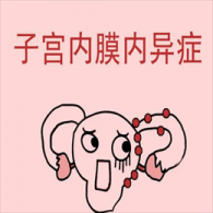 子宮內(nèi)膜異位癥懷孕