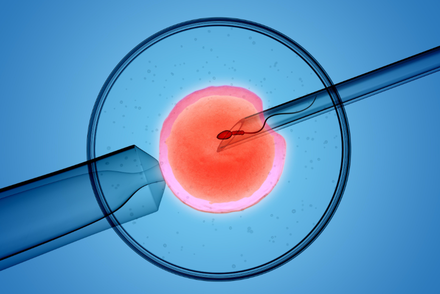胚胎移植