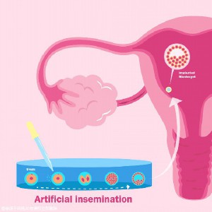 唐山第三代試管機(jī)構(gòu)排名前三，附各大醫(yī)院情況介紹