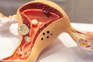 南京做試管嬰兒要多少錢？南京做試管哪家醫(yī)院成功率高？