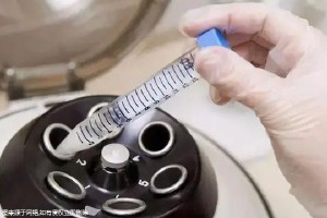 曼谷試管嬰兒成功率哪家醫(yī)院高？高血壓患者能否在曼谷進行試管嬰兒手術(shù)？